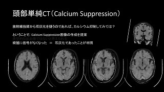 IQon Spectral CT クリニカル・ケース case 66