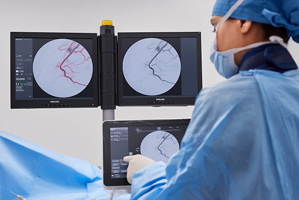 surgeon activates automatic vascular outlining on the tsm