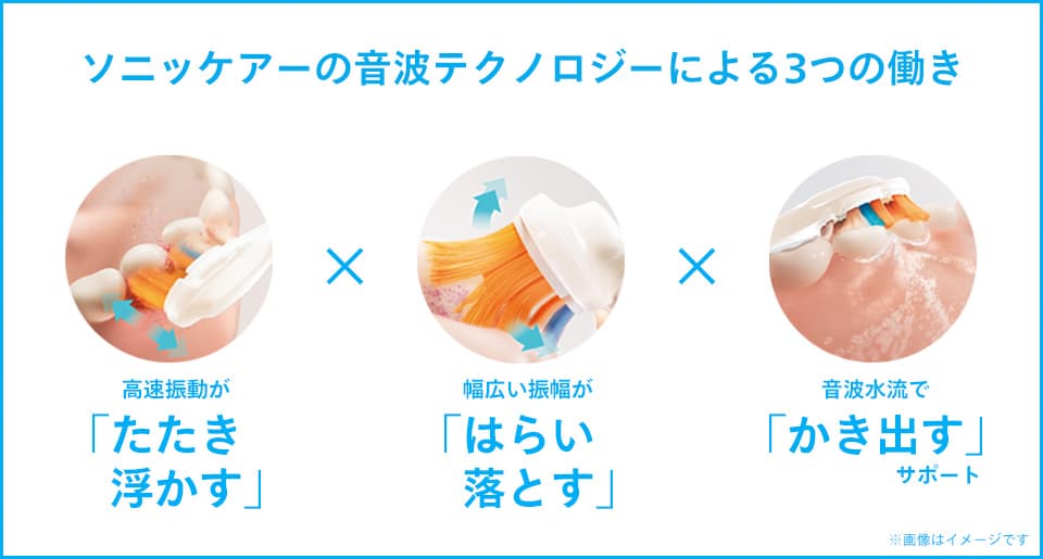 ソニッケアー