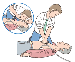 心肺蘇生とAED-胸骨圧迫と人工呼吸