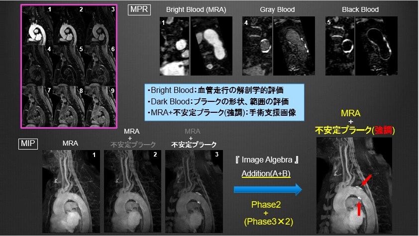 Gyro Cup 2020 Bronze Award 発表スライド 2