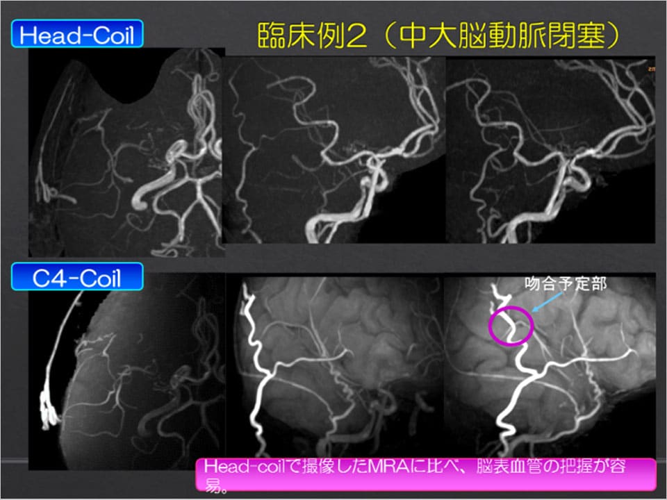 Gyro Cup 2014 Special Award 発表スライド 2