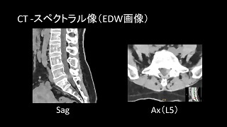 IQon Spectral CT-63