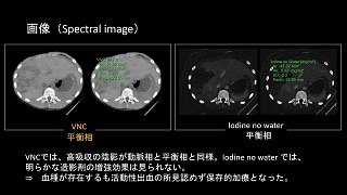 iqon-clinical-case81