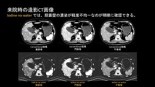 Clinical case 82