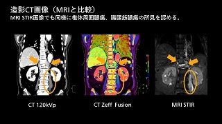 Clinical case 85