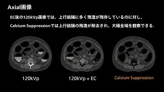 Clinical case 88