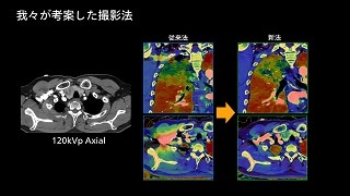 case 89: 肺血栓塞栓症ルールアウト検査の撮影法