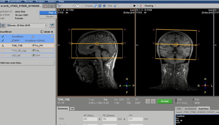 Philips Prodiva (Brain)