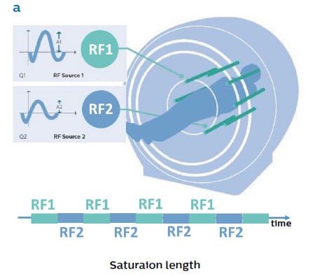 図2.MultiTransmit 4Dの応用　Saturaion length