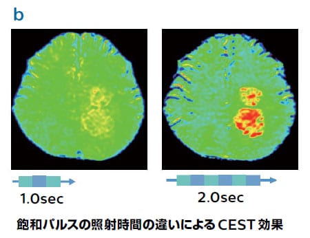 図2.MultiTransmit 4Dの応用　飽和パルスの照射時間の違いによるCEST効果