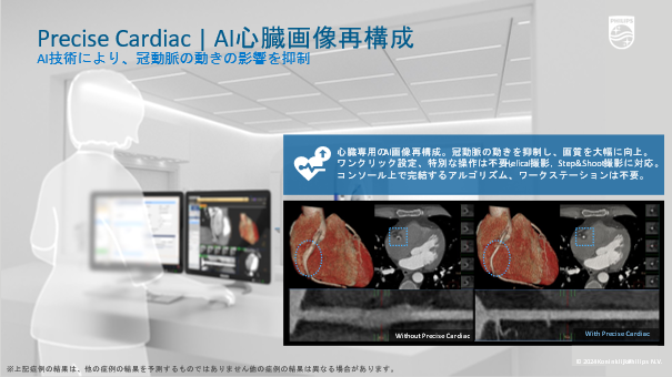 Precise Cardiac: AI 心臓画像再構成