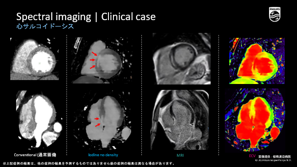 Spectral imaging: Clinical case