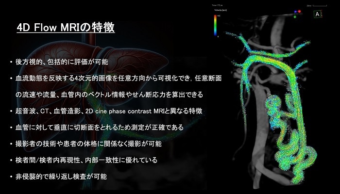 第43回日本画像医学会学術集会 ランチョンセミナー 講演資料 1