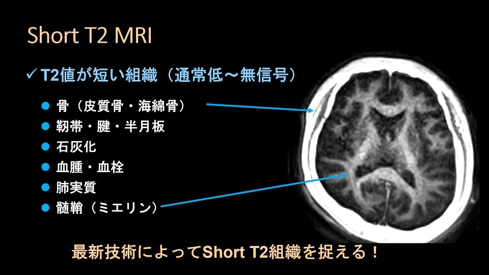 第51回日本磁気共鳴医学会大会 LS2 講演資料