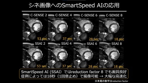 第16回Philips画像診断Webセミナー 講演資料 1