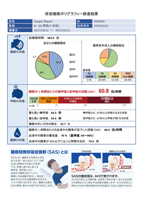 終夜睡眠ポリグラフィー検査結果のサンプル