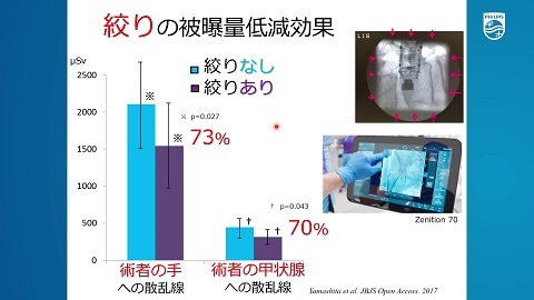 整形外科診療に伴う職業被曝の実態とその対策（後編）