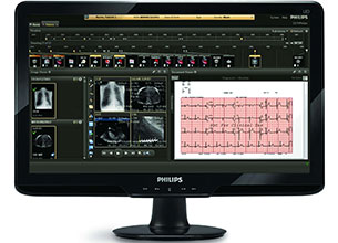 Philips CVISシステム上での患者の心拍記録モニタリング