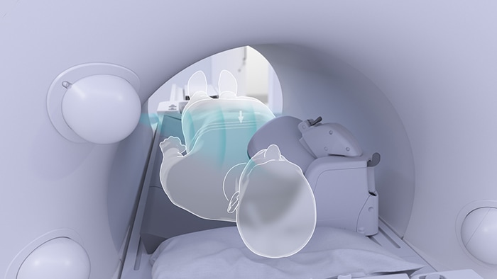 スキャンの準備に使用する、タッチレス患者センシング機能を備えたMRIシステムと患者の写真 image