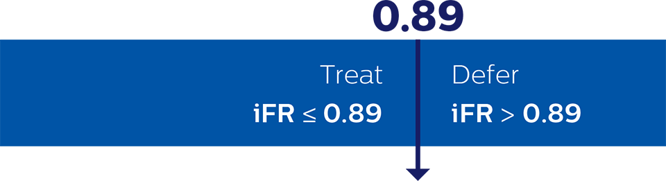 iFR カットポイント