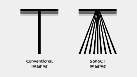 SonoCTリアルタイムコンパウンドテクノロジー image
