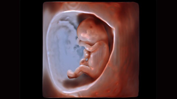 Philips GlassVueによる妊娠早期の胎児