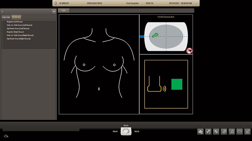 AI Breastレジストレーション画面