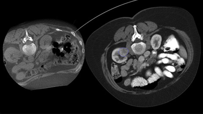 CBCT image