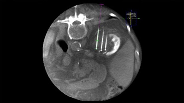 Dual Viewを使用したCBCT 3D画像