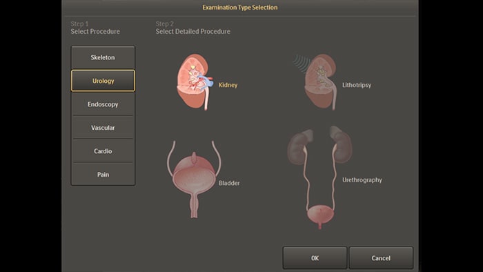 泌尿器および内視鏡手技のデフォルトの解剖学的設定
