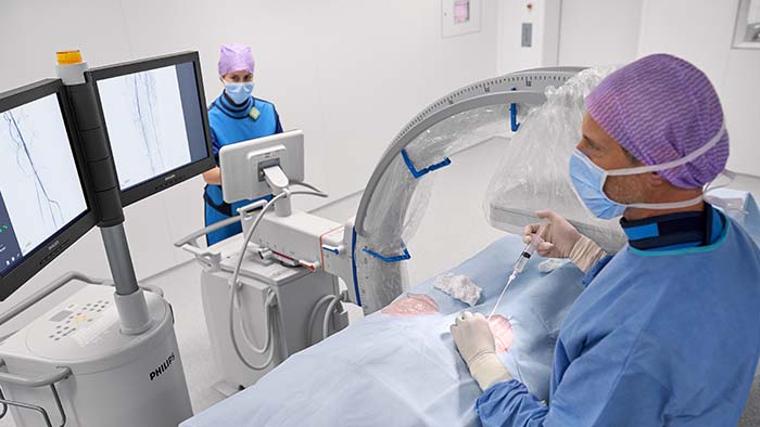 Mobile C-arm for Vascular