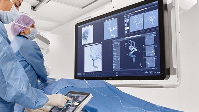 Cerebral Aneurysm treatment