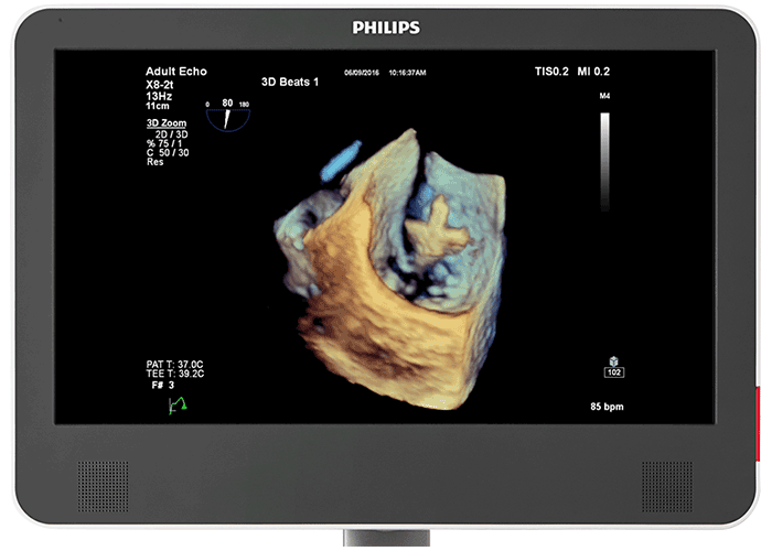 X8-2t  次世代Live 3D TEE用の設計