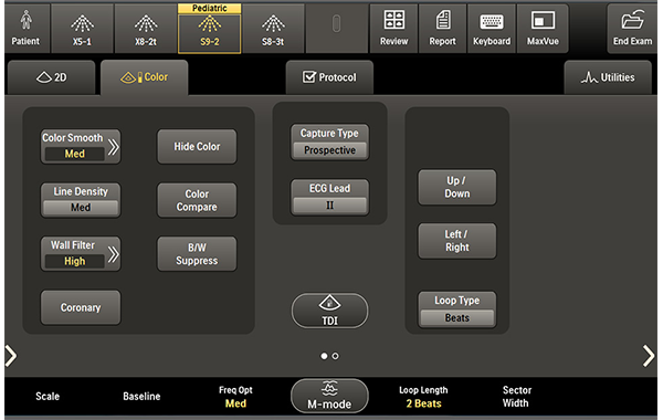 CVx S9 2 2DカラーTS 循環器科 UI