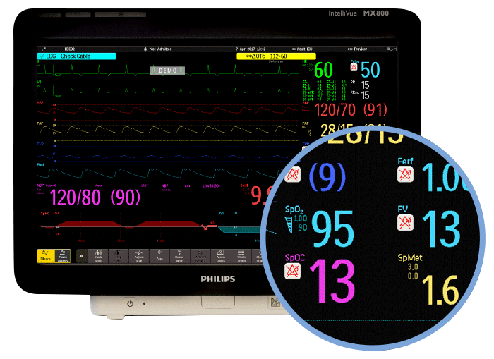 Masimo Rainbow SETのパラメータ