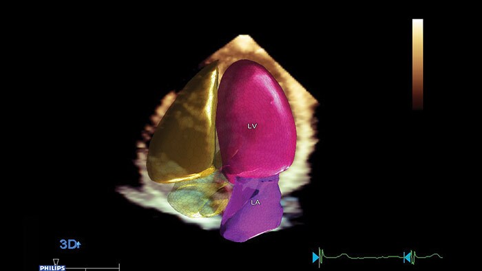 Anatomical Intelligence for Ultrasound(AIUS)