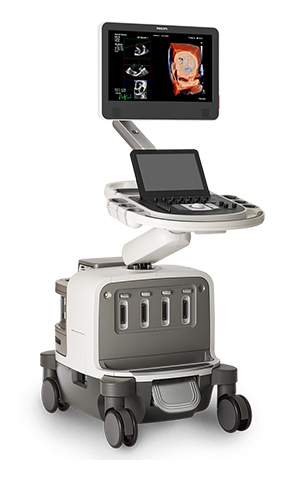 EPIQ 7超音波診断装置