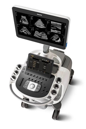 Epiq Elite超音波診断装置