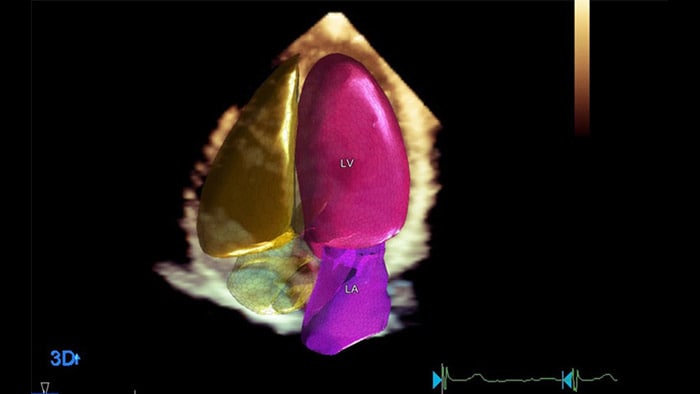 Dynamic HeartModel