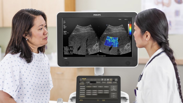 肝臓の超音波診断