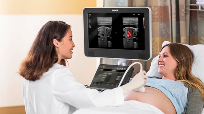産婦人科向けMicroFlow Imaging