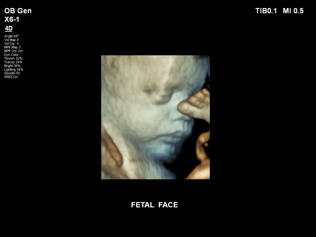 胎児の顔