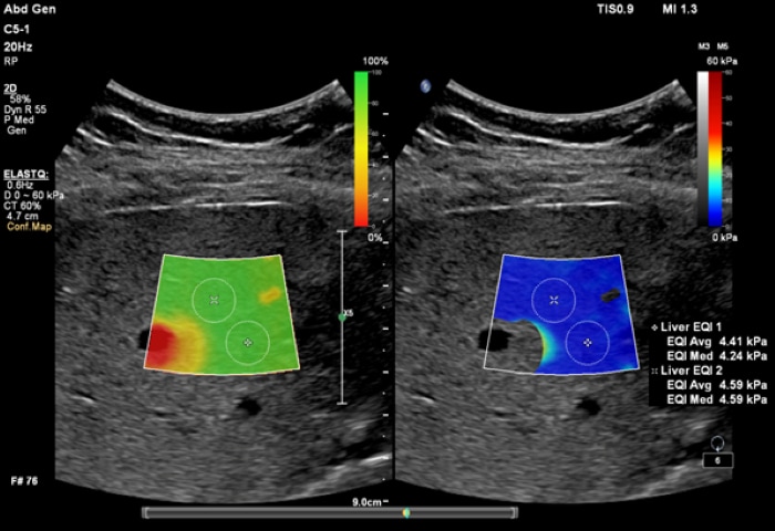 ElastQ Imaging