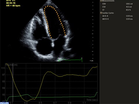 Anatomical Intelligence - Automated 2D