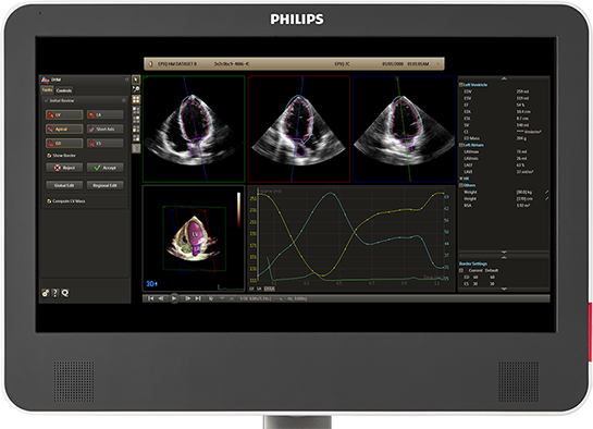 Dynamic Heart Model臨床用途の拡大と診断確度の向上を実現する