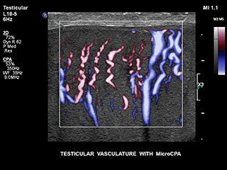 MCPAによる精巣血管系