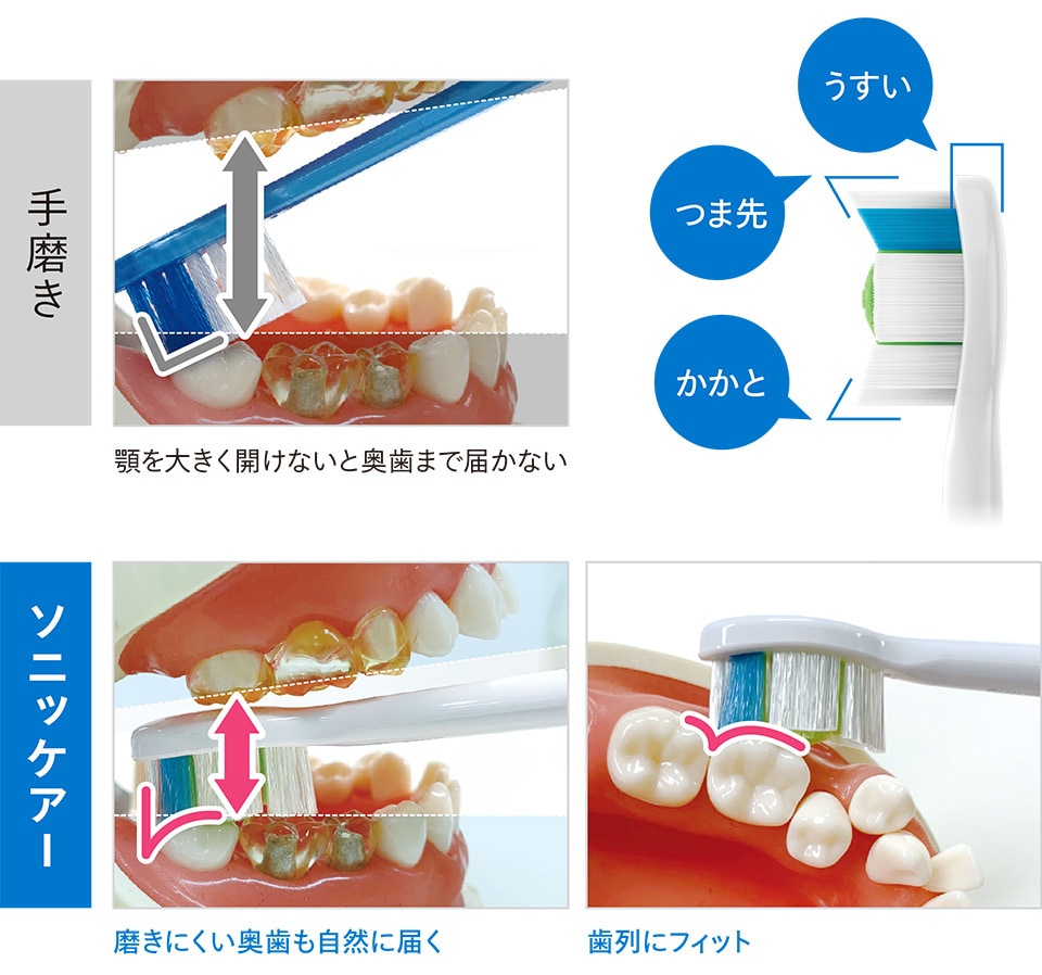 手磨きだと顎を大きく開けないと奥歯まで届かないが、ソニッケアーはブラシヘッドの形状により奥歯にも自然に届くことを示す図