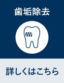 歯垢除去が気になる人向けの診断表に移動するボタン