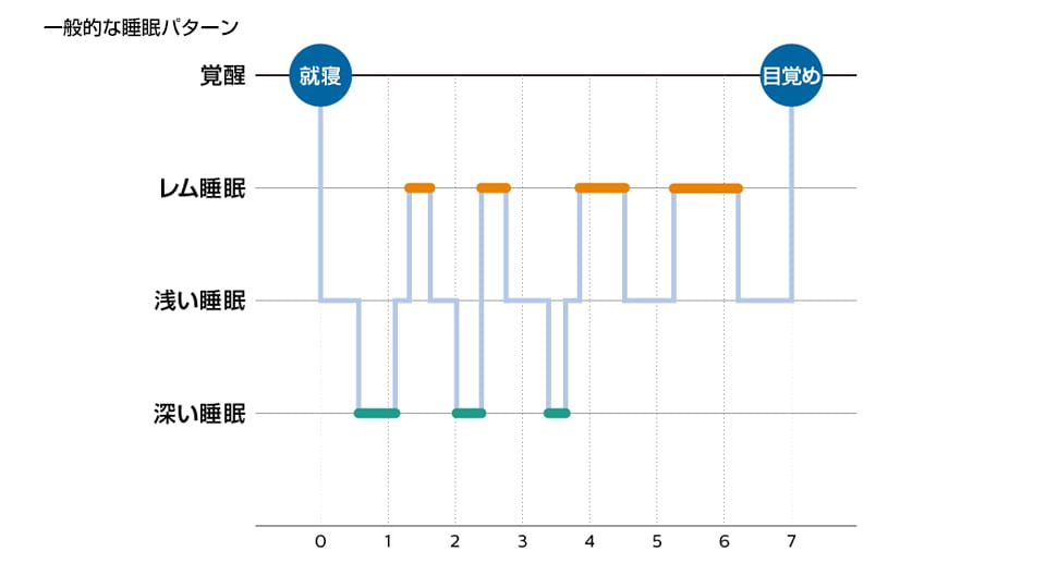 睡眠パターングラフ